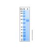 Recombinant Human CD10 Protein