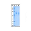 Recombinant Human PDGFR alpha Protein