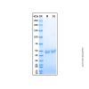 Recombinant Human Serpin E2/PN1 Protein