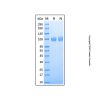 Recombinant Mouse ACE-2 Protein