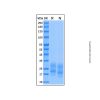 Recombinant Mouse GM-CSF Protein