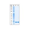 Recombinant Mouse IL-1 beta Protein