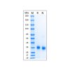 Recombinant Human SARS-CoV-2 Spike Protein RBD - by