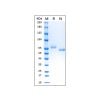 Recombinant Human Transferrin Protein