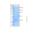 Recombinant Human MBL Protein - by