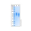Recombinant Human TrkB Protein - by