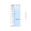 Recombinant Human Annexin V/ANXA5 Protein