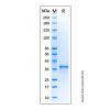 Recombinant Human Estrogen Receptor beta Protein