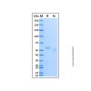 Recombinant Human ATM Protein