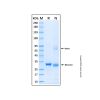 Recombinant Human ATR Protein