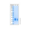 Recombinant Human GIPR Protein - by