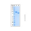 Recombinant Human Complement C7 Protein - by