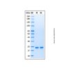 Recombinant Human KRAS (G12A) Protein
