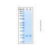 Recombinant Human KRAS (Q61H) Protein