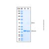 Recombinant Human PPARG Protein - by Aladdin Scientific
