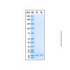 Recombinant Human ABL1 Protein - rp217149 by Aladdin Scientific