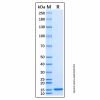 Recombinant Human CFTR Protein - by Aladdin Scientific