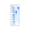 Recombinant Human FGFR2 Protein