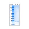 Recombinant Human IL-6 Protein -    by