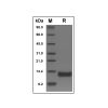 Recombinant Human BAFFR/TNFRSF13C Protein -    by