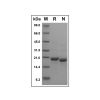 Recombinant Human CD23 Protein -    by